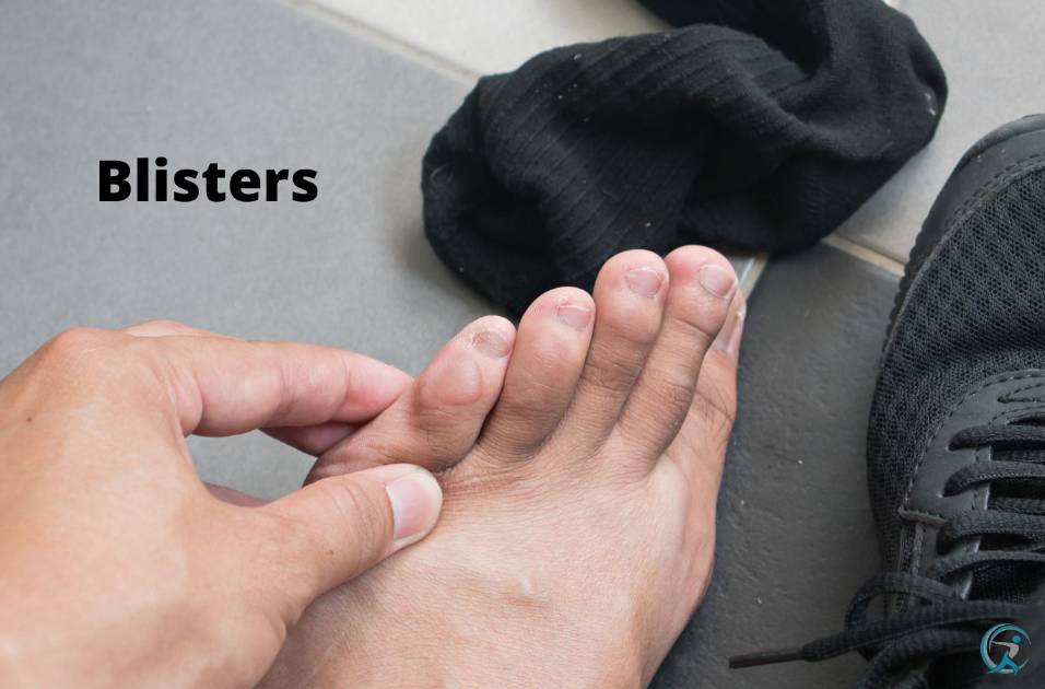 Blisters