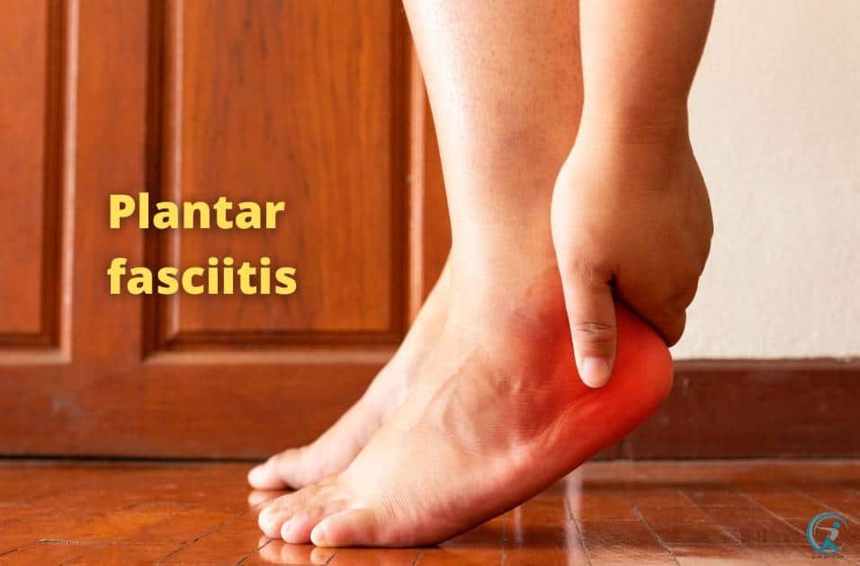 Plantar fasciitis