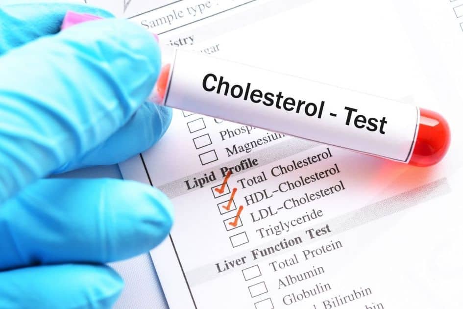 Cholesterol test