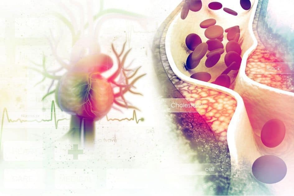 Conclusions about the cholesterol myth