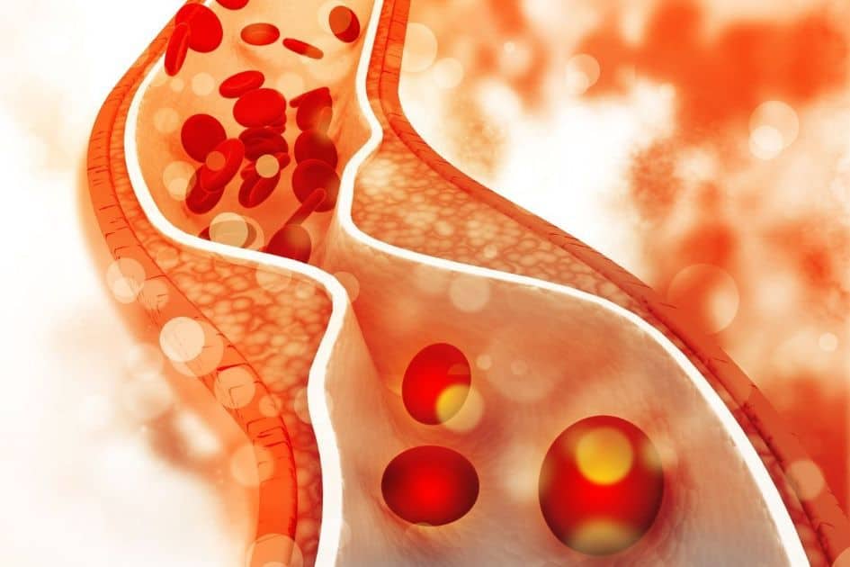 The Cholesterol myth - Cholesterol is not technically a fat; instead, it is classified as a sterol, a combination of a steroid (fat) and alcohol