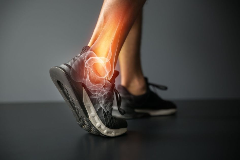 Any physical activity like running can result in an injury