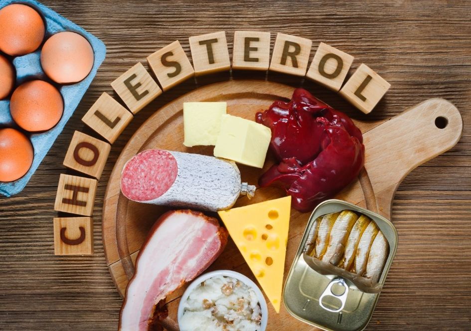 High-cholesterol foods