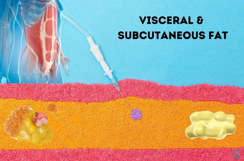 The different types of abdominal fat are visceral and subcutaneous fat