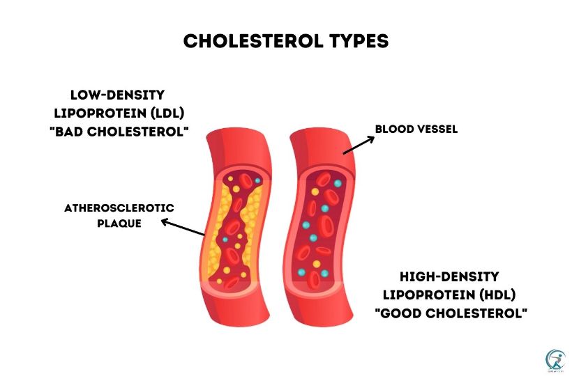 What is high cholesterol, and what are the risks associated with it