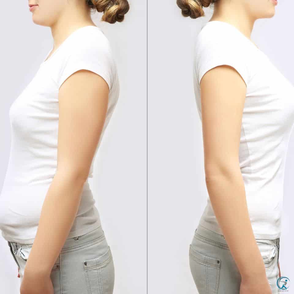 Additional Lifestyle Changes to Improve Posture